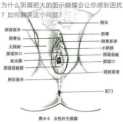 为什么阴脣肥大的图示蝴蝶会让你感到困扰？如何解决这个问题？